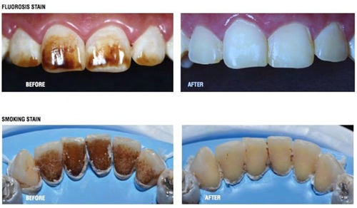 MDC Antivet Bleaching Agent - Image 4