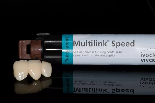 Ivoclar Vivadent Multilink Speed Refill 6gm - Image 4