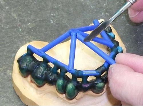 Maarc Dental Wire Wax Specially Designed Wax For Creating Sprues In Dental Casting - Image 4