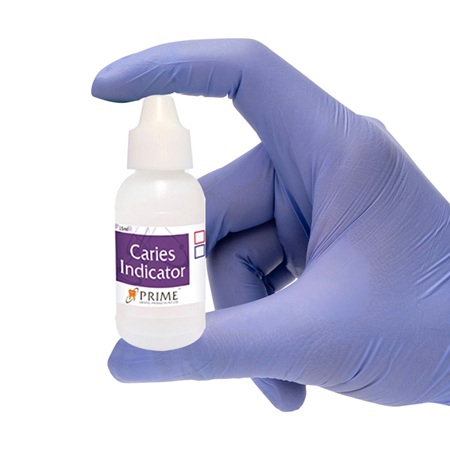 Prime Dental Caries Indicator 15ml - Image 4