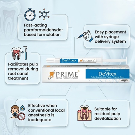 Prime Dental DeVitex Pulp Devitalising Paste - Image 3