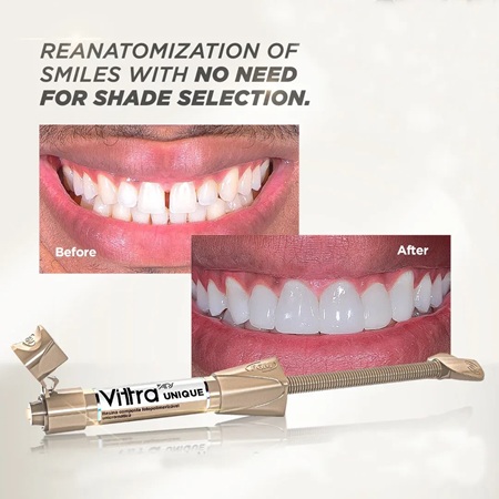 FGM Vittra APS Unique Light Cured Chroma Composite Universal Shade - Image 3