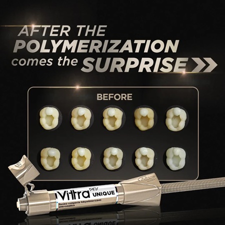 FGM Vittra APS Unique Light Cured Chroma Composite Universal Shade - Image 4